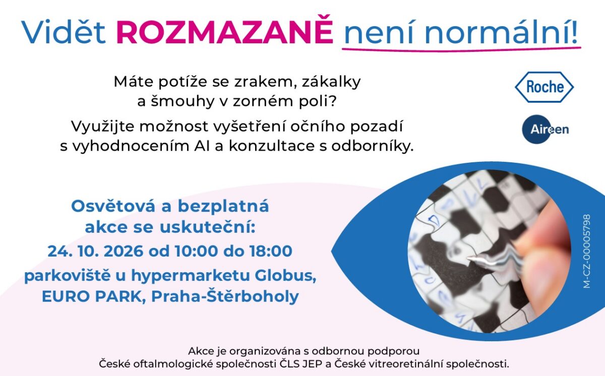 Pozvánka na oční vyšetření zdarma